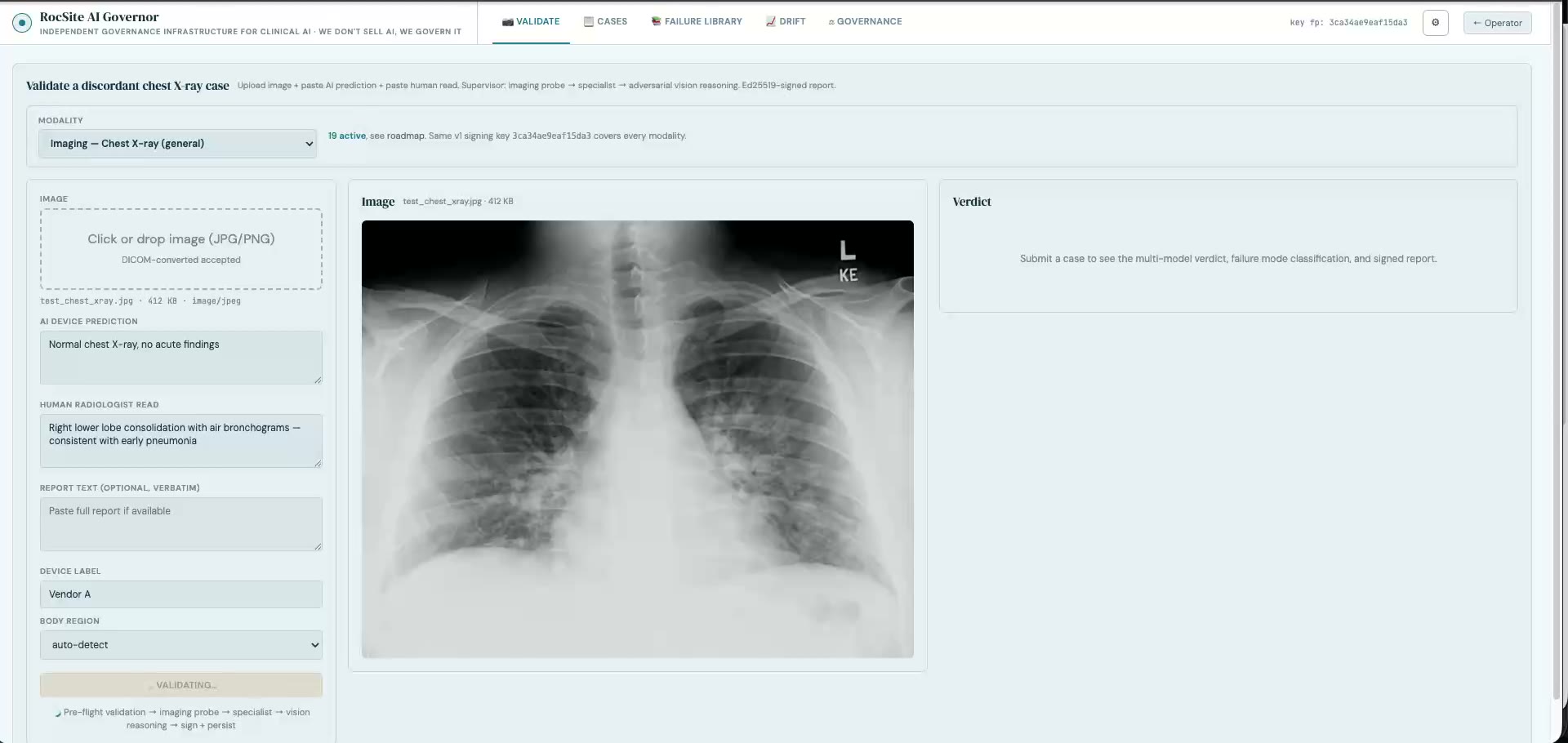Chest X-ray thumbnail